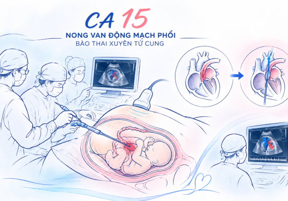 TP. Hồ Chí Minh: Ca thông tim bào thai thứ 15 thành công