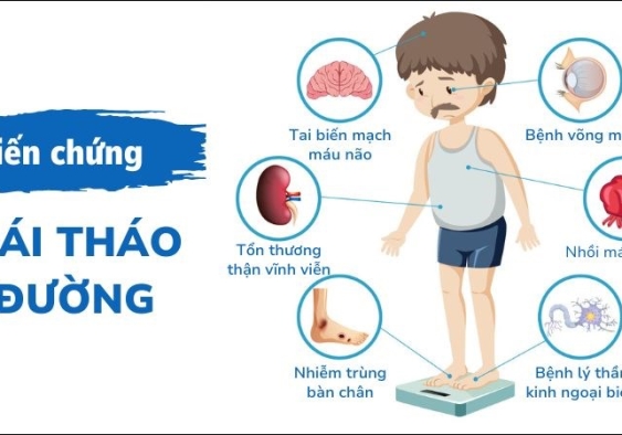 Các biến chứng của bệnh đái tháo đường Các biến chứng của bệnh đái tháo đường