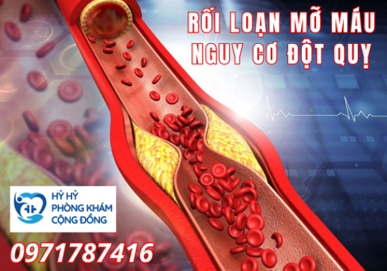 Rối loạn mỡ máu - nguy cơ đột quỵ | Tầm soát mỡ máu tại Tân Phú