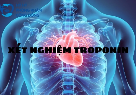 Xét nghiệm Troponin