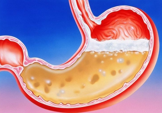 Thuốc kháng acid dạ dày (Antacid) là gì? Nên uống trước hay sau ăn để đạt hiệu quả?
