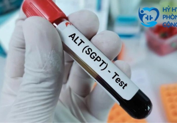 Xét nghiệm Alanine Transaminase (ALT) là gì