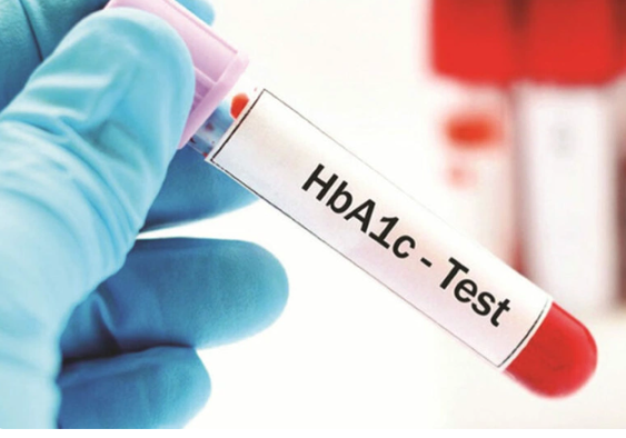 Xét nghiệm HbA1c là gì? 