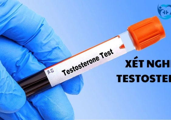 Xét nghiệm Testosterone