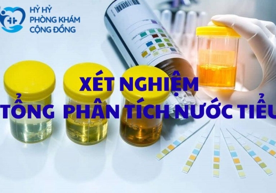 Xét nghiệm tổng phân tích nước tiểu 