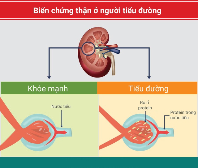 cac-bien-chung-cua-dai-thao-duong