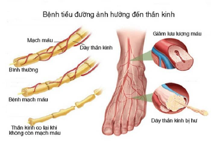 cac-bien-chung-cua-dai-thao-duong