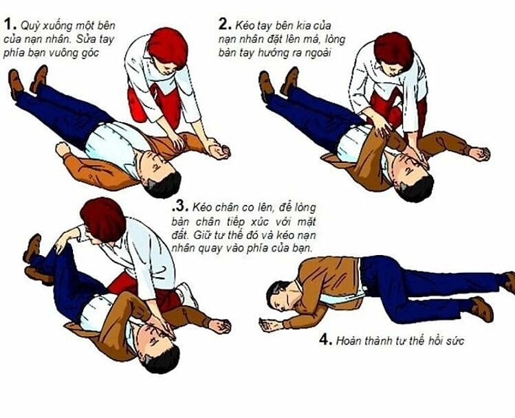 Cách Sơ Cứu Đột Quỵ Đúng Cách Tại Nhà – Những Việc Cần Làm Ngay
