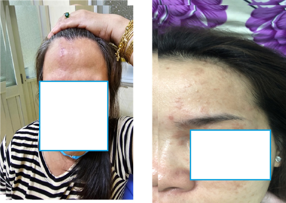 -zona-vùng-mặt-kinh-tế-tinh-thần-điều-trị-tân-phú