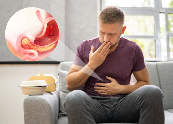 Đau vùng thượng vị, ợ hơi khó chịu là biểu hiện của bệnh đau dạ dày