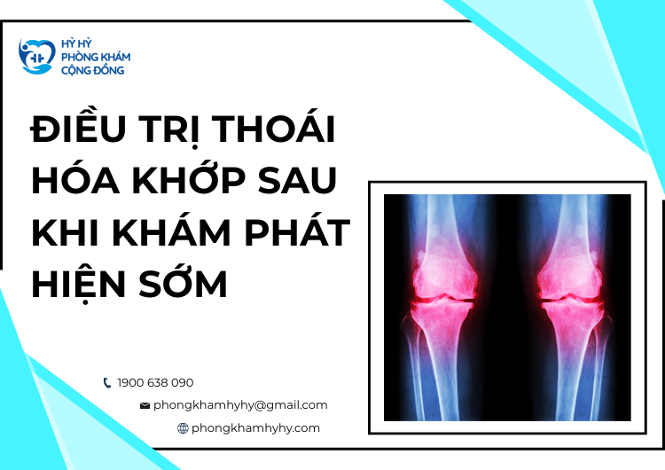 Điều Trị Thoái Hóa Khớp Sau Khi Khám Phát Hiện Sớm 