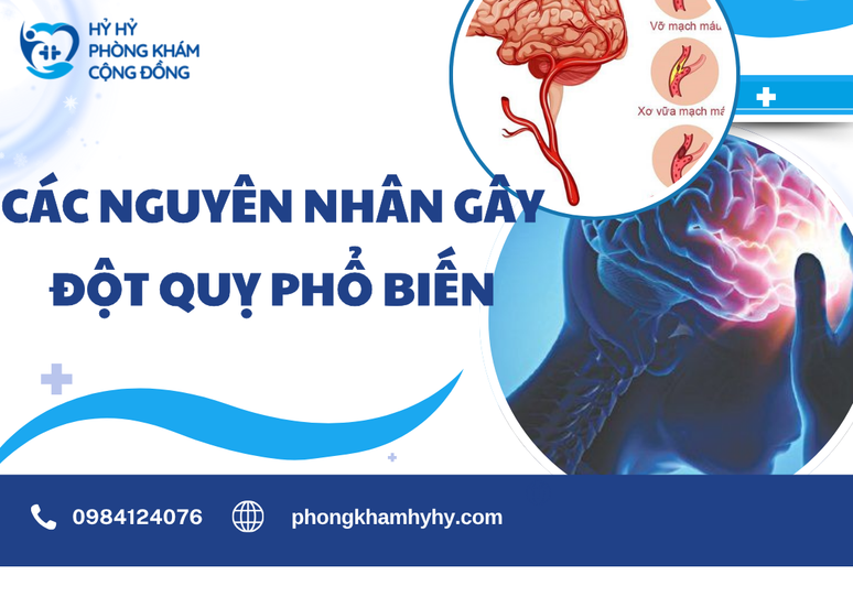 Các Nguyên Nhân Gây Đột Quỵ Phổ Biến – Hiểu Đúng Để Chủ Động Phòng Ngừa Từ Sớm