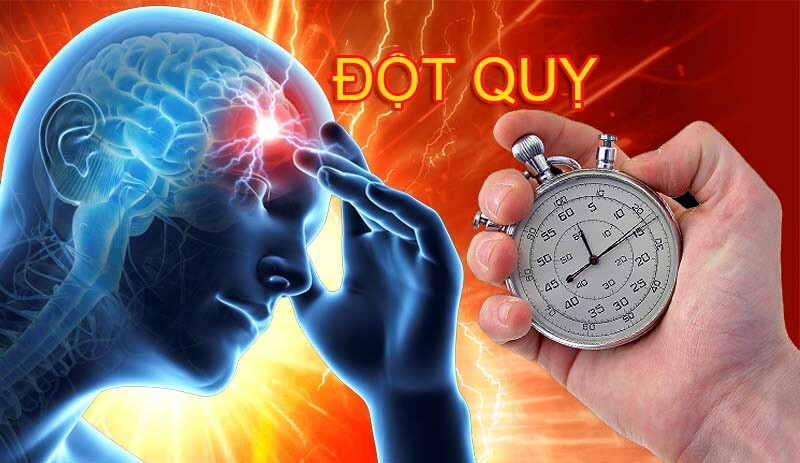 Huyết Áp Cao – Nguyên Nhân Gây Đột Quỵ Hàng Đầu