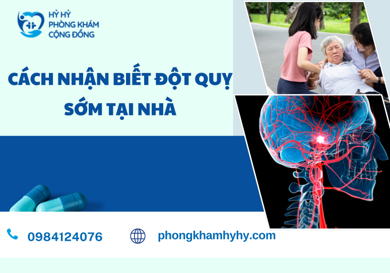 Cách Nhận Biết Đột Quỵ Sớm Tại Nhà – Hướng Dẫn Chi Tiết Từ Chuyên Gia