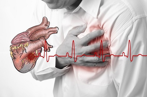Các Dấu Hiệu Đột Quỵ Khác Thường Bị Bỏ Qua