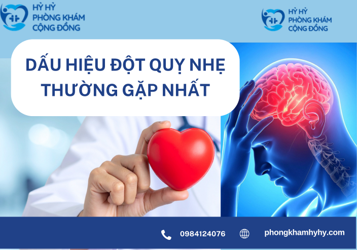 Dấu Hiệu Đột Quỵ Nhẹ Thường Gặp Nhất – Đừng Chủ Quan Với Những Biểu Hiện Thoáng Qua