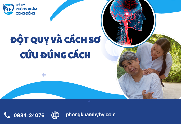 Đột Quỵ Và Cách Sơ Cứu Đúng Cách: Hướng Dẫn Chi Tiết Từ Chuyên Gia Để Bảo Vệ Tính Mạng