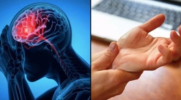 Phòng Ngừa Đột Quỵ Hiệu Quả Cho Người Bệnh Tiểu Đường