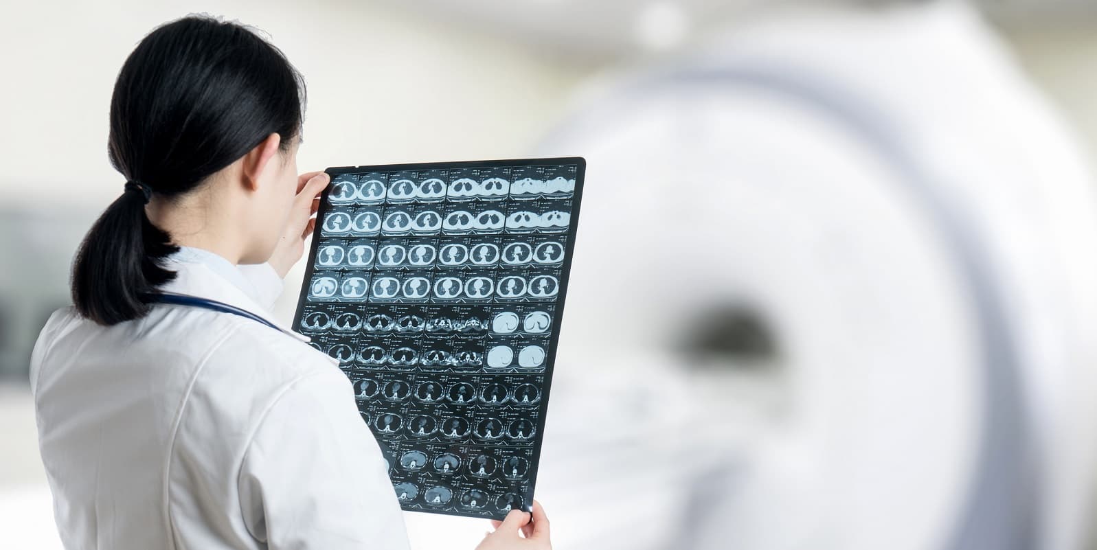 Khám Đột Quỵ Có Nhất Thiết Phải Chụp MRI Không?
