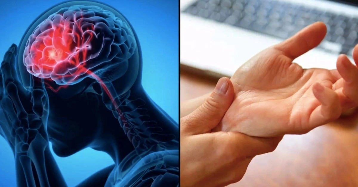 Dấu Hiệu Đột Quỵ Ở Người Già Rõ Nhất Theo Quy Tắc FAST