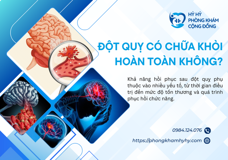 Đột Quỵ Có Chữa Khỏi Hoàn Toàn Không? Khả Năng Hồi Phục Phụ Thuộc Vào Những Yếu Tố Nào?