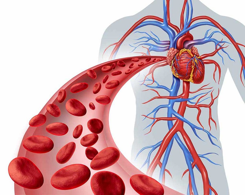 Rối Loạn Mỡ Máu - Yếu Tố Có Thể Làm Tăng Nguy Cơ Đột Quỵ Ở Người Trẻ