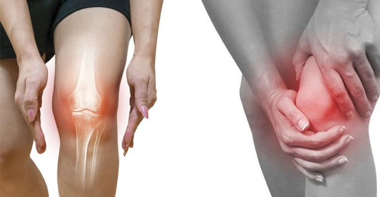 Viêm khớp dạng thấp và thoái hóa khớp