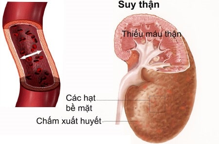 Xét nghiệm chức năng thận