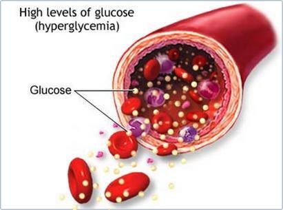 Glucose