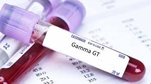 Xét nghiệm GGT