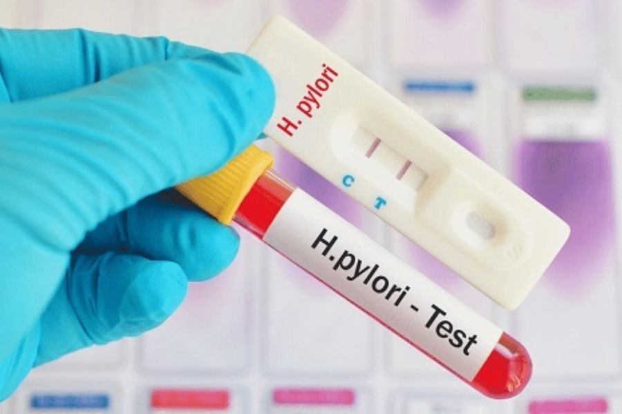 Xét nghiệm H.Pylori