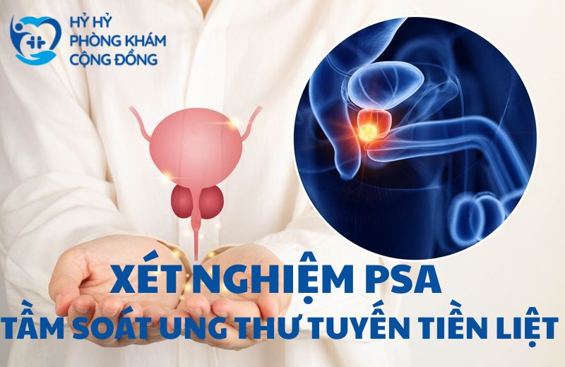 Xét nghiệm PSA
