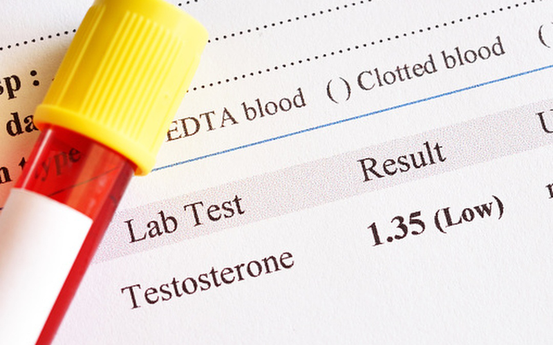 Xét nghiệm Testosterone