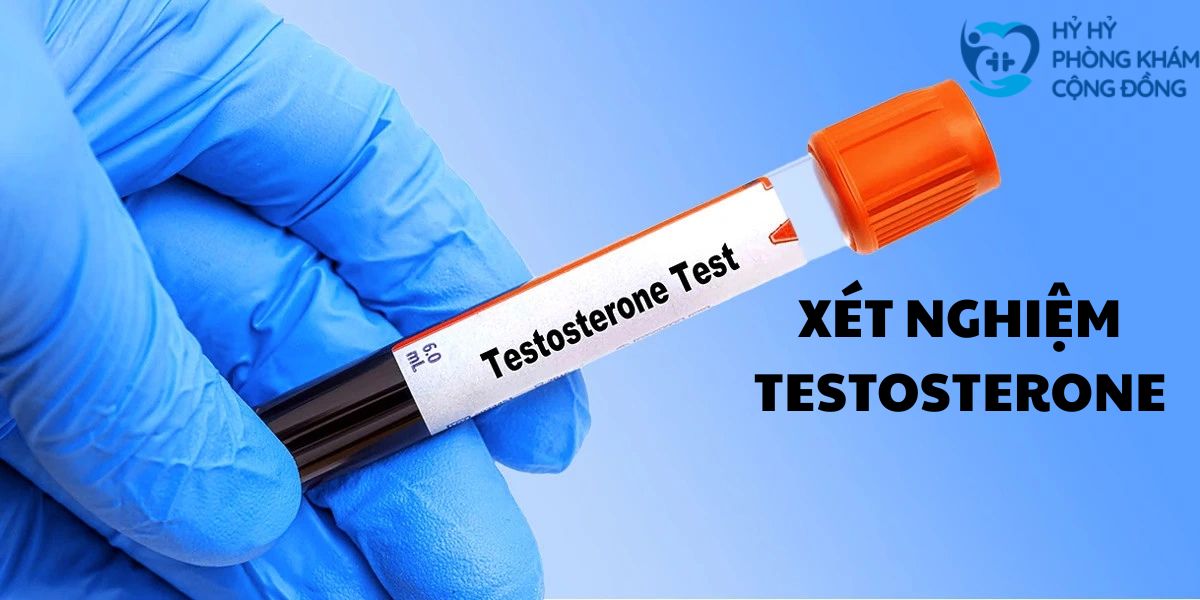 Xét nghiệm Testosterone