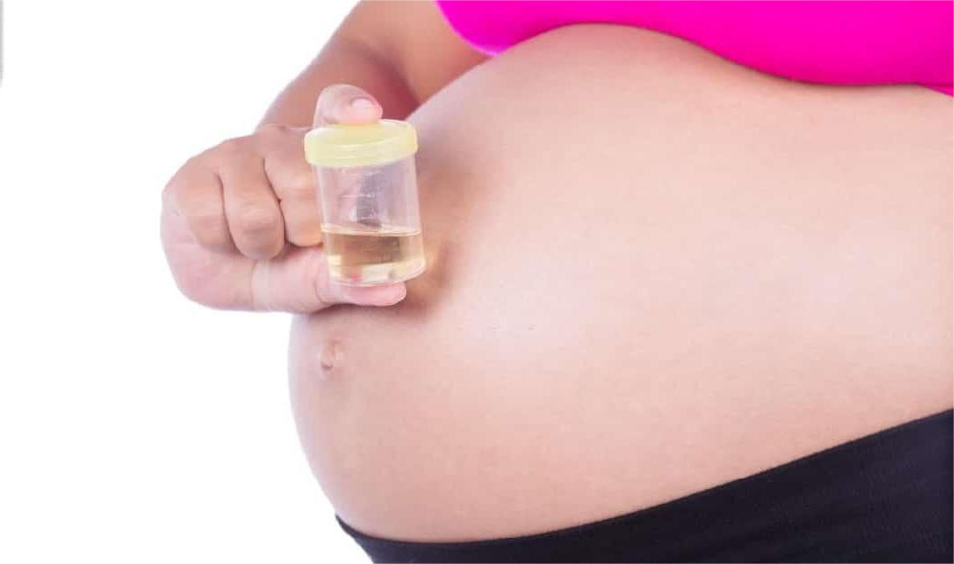 Xét nghiệm tổng phân tích nước tiểu