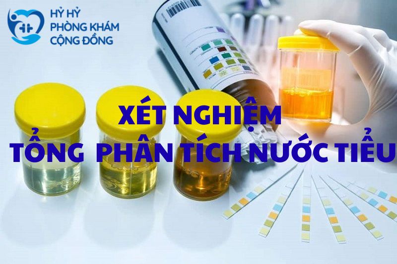 Xét nghiệm tổng phân tích nước tiểu