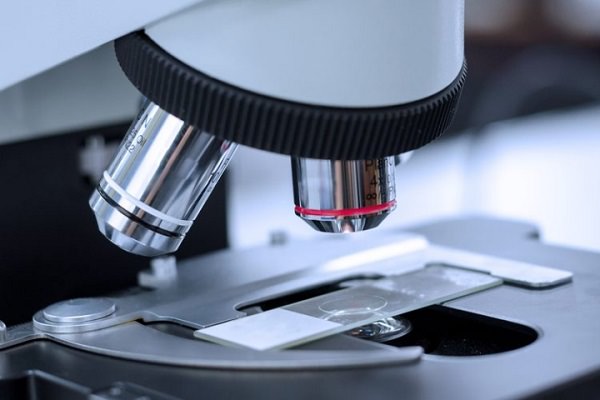 Xét nghiệm tổng phân tích nước tiểu